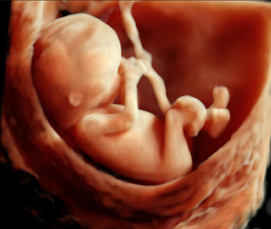 Diagnostyka prenatalna